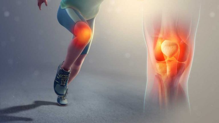 Osteoartrite: un grande problema per l’atleta